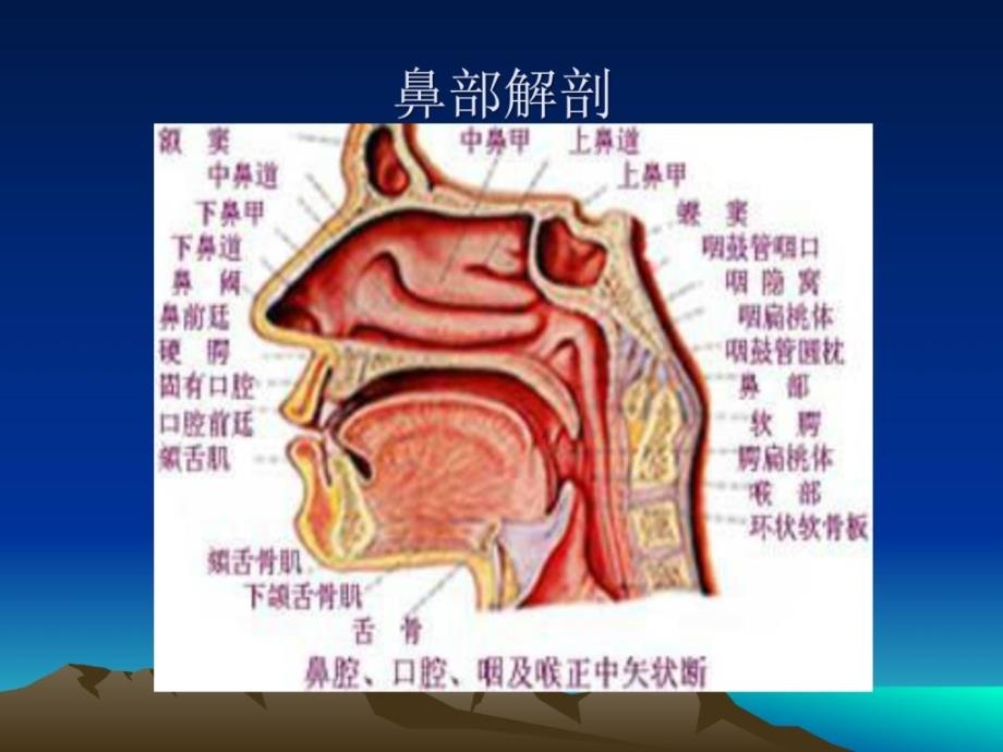 耳鼻喉罕见病[精品]_第2页