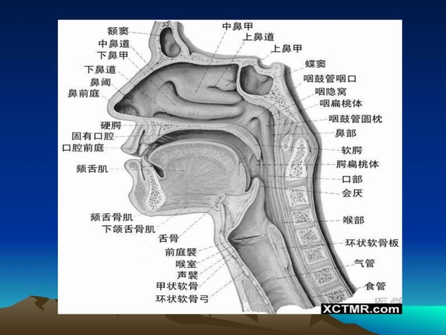 耳鼻喉罕见病[精品]_第4页