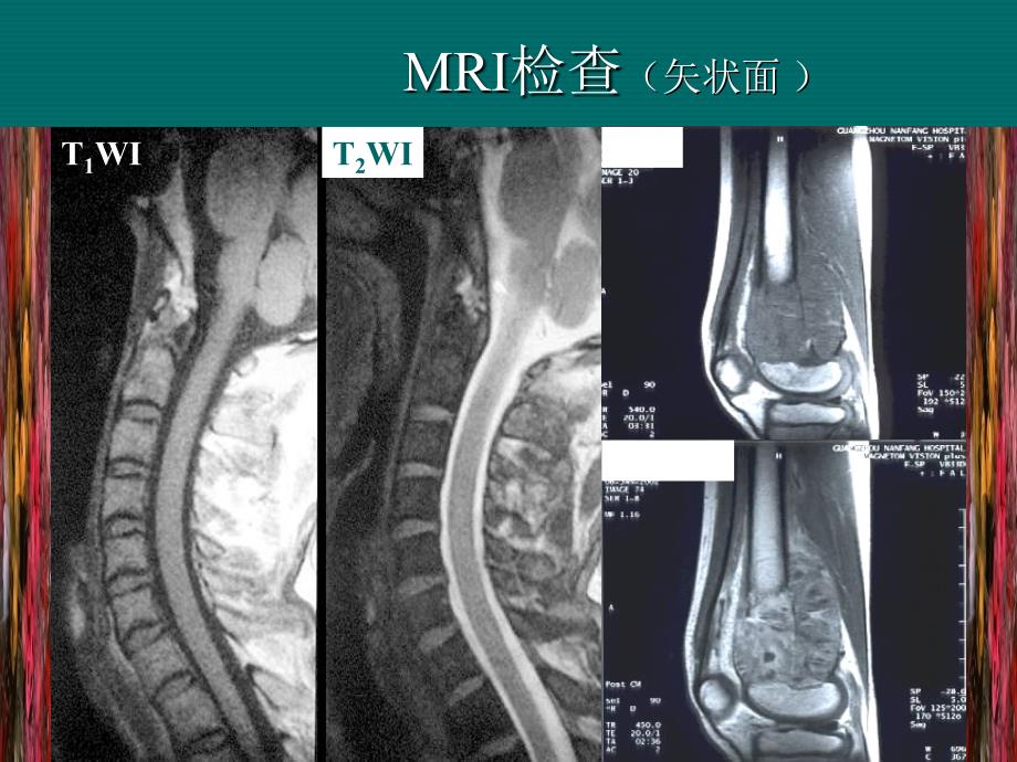 见习8-CT应用综述_第4页