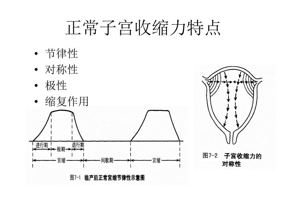 异常分娩-产力异常_第5页