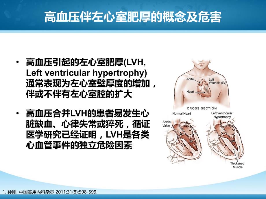 左心室肥厚高血压靶器官损伤重要干预靶点 (1)_第2页