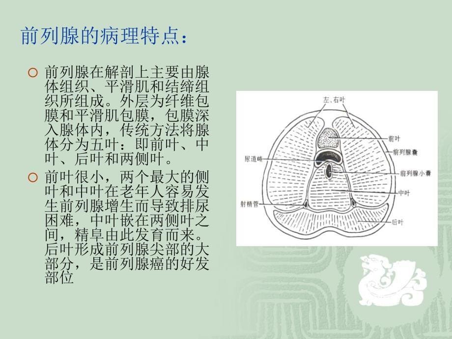 良性前列腺增生._第5页