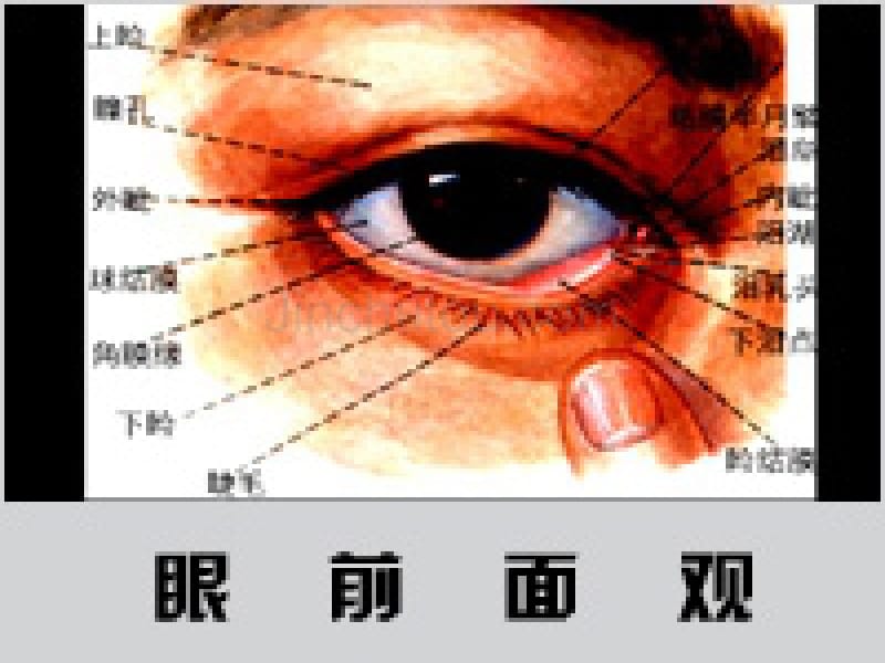 眼病与眼保健[优质文档]_第4页