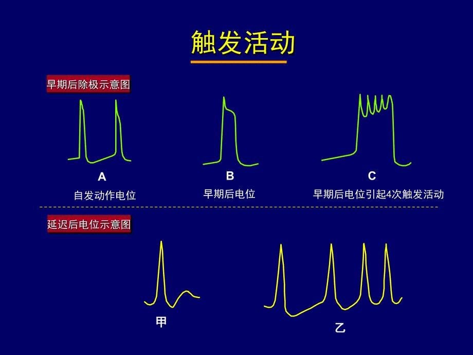 常见心律失常诊断和处理浙江大学医学院附属第一医院心内科_第5页