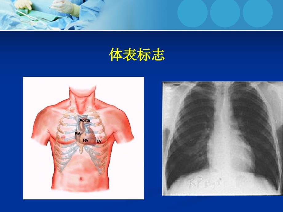 心内科体格检查综述_第4页