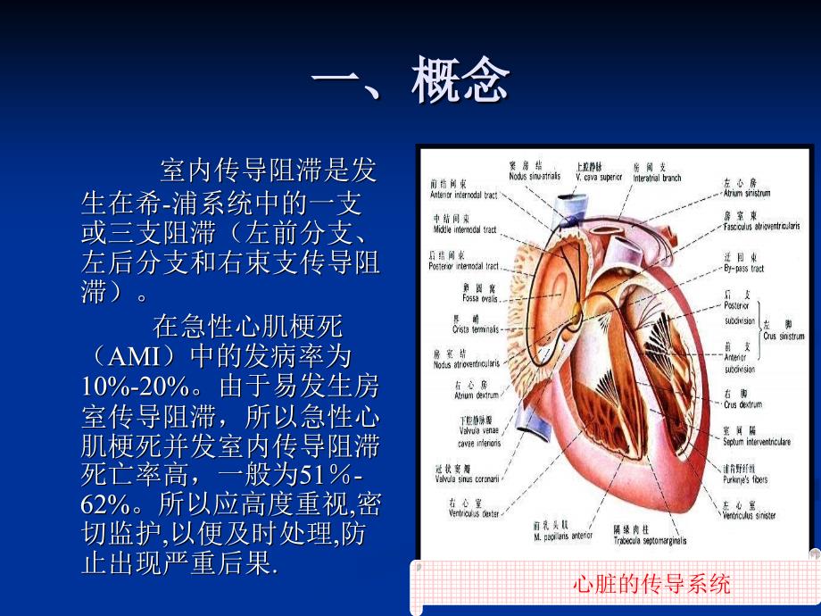 室内传导阻滞在急性心肌梗死中的临床意义及治疗原则精要_第2页