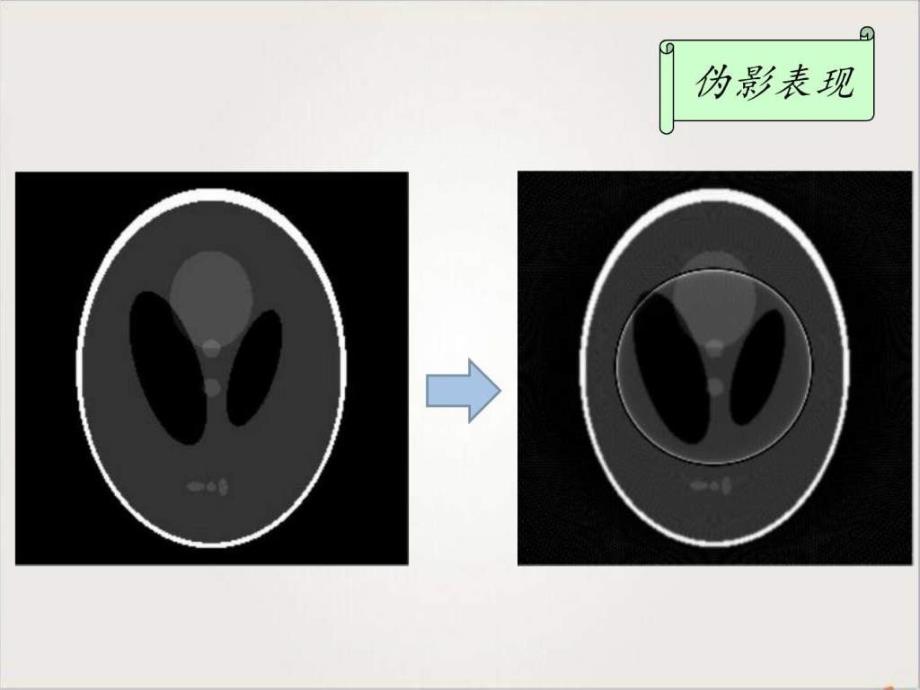 图像处理环形伪影去除及去噪._第4页