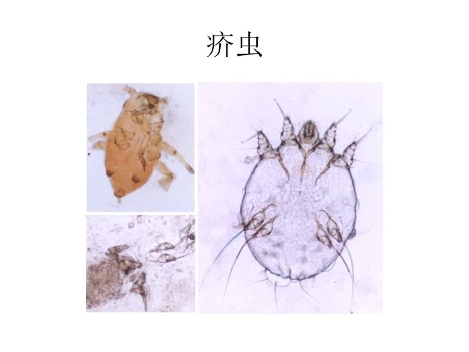 皮肤性病学植物性皮肤病_第3页