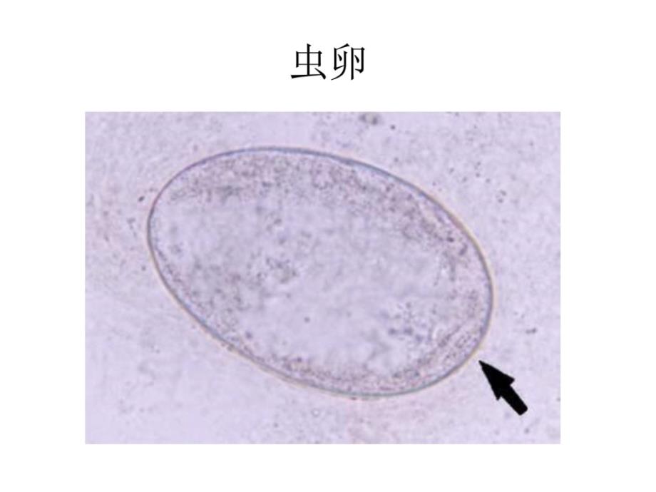 皮肤性病学植物性皮肤病_第4页