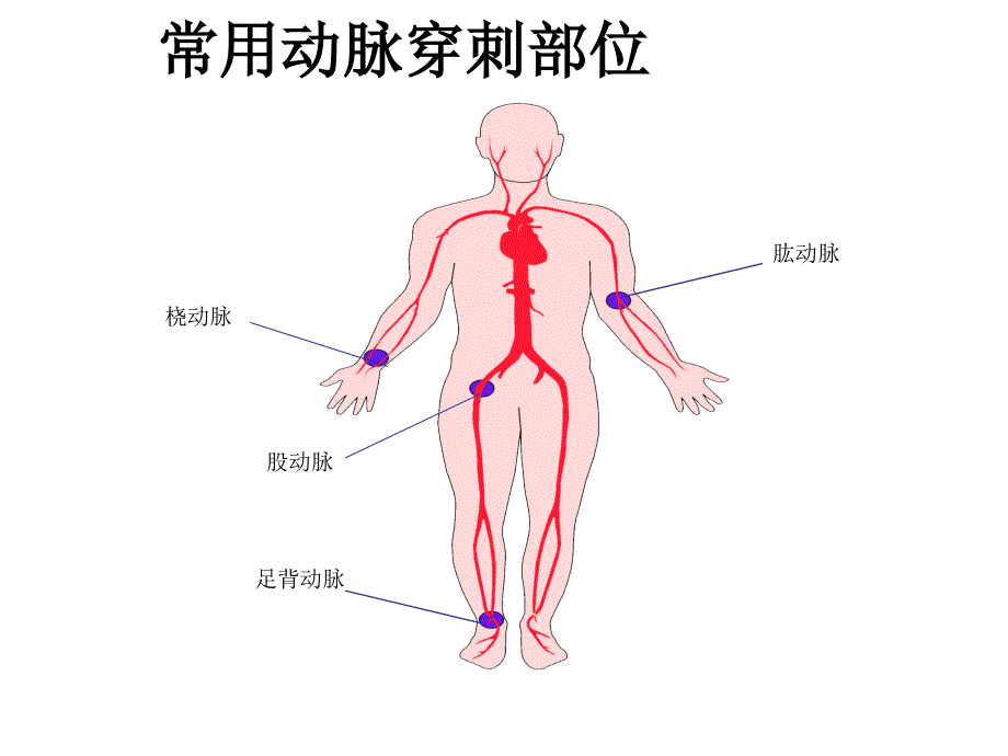 如何抽取动脉血综述_第2页