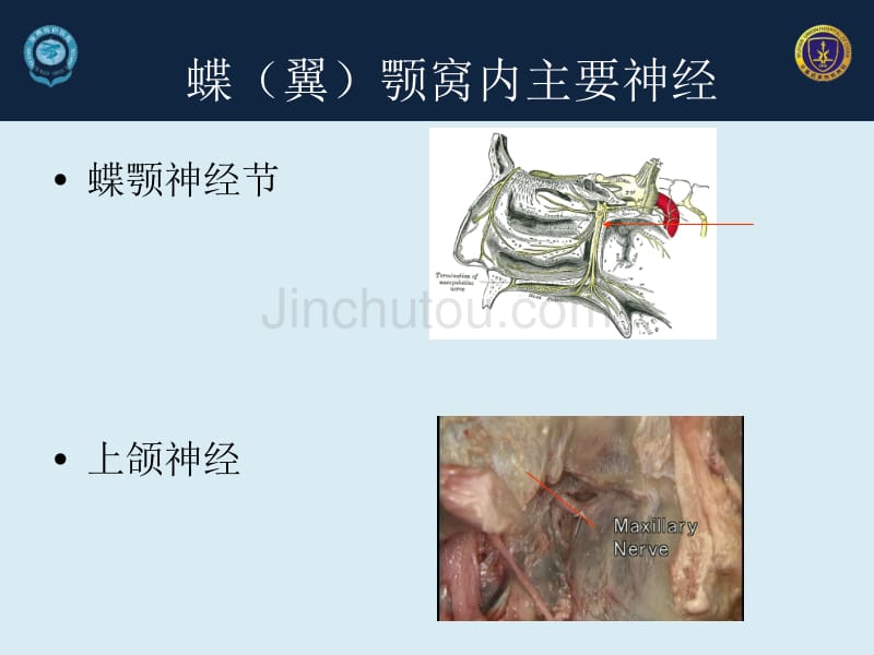 经蝶(翼)颚窝穿刺技术在头面痛中的应用_第2页