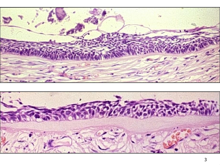 牙源性肿瘤Odontogenic Tumors_第3页