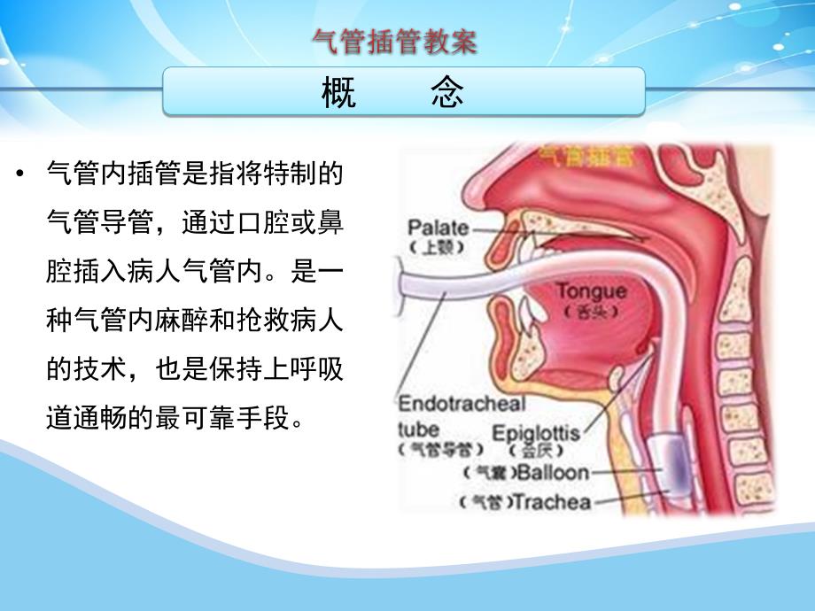 气管插管教案._第2页