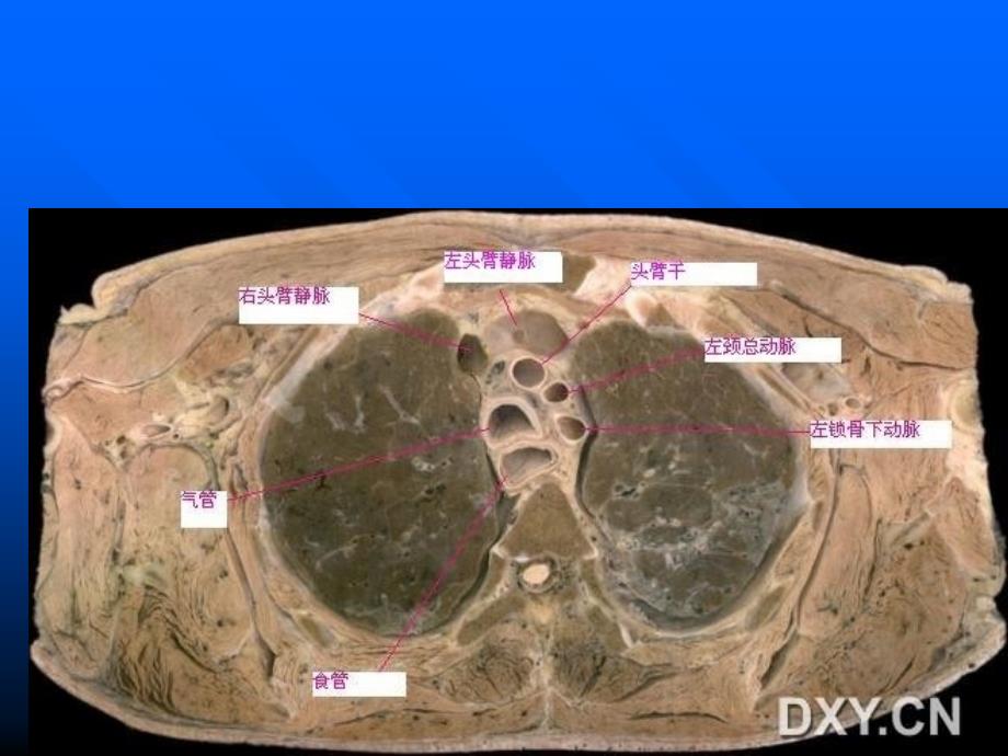 肺部正常CT_第4页