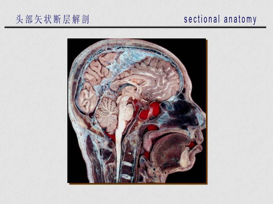 头部矢状断层解剖_第3页