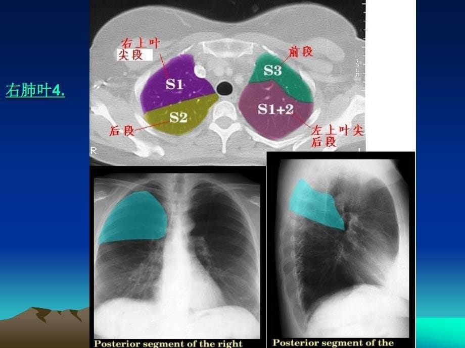 ct正常彩色解剖图谱 课件_第5页