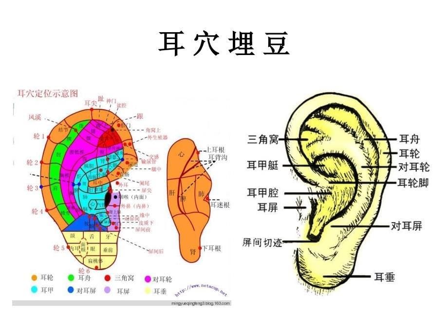 耳穴埋豆护理版_第5页