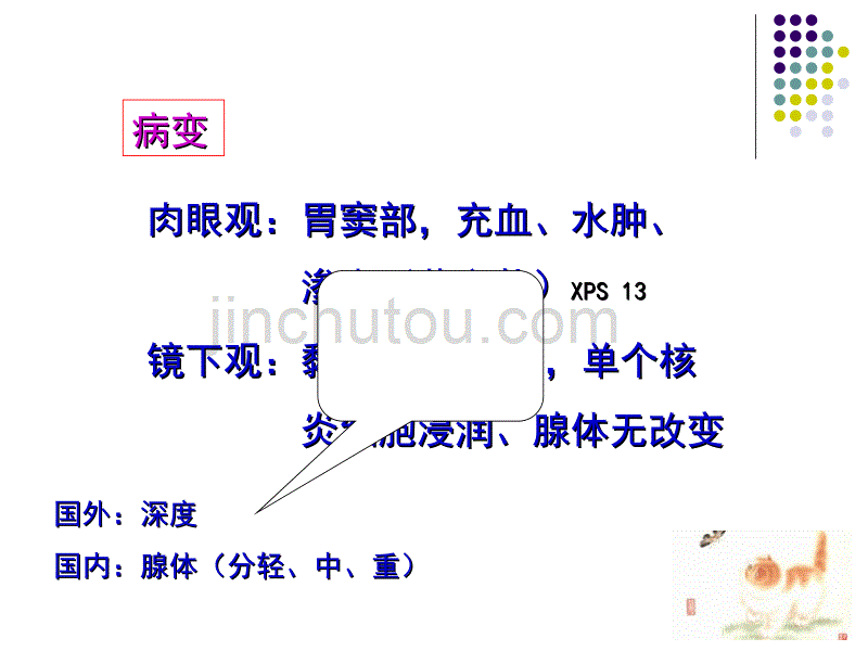 消化系统疾病2资料_第5页