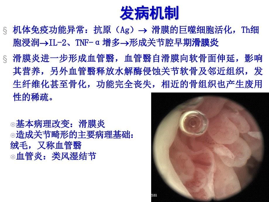 RA(护本内科护理学)_第5页