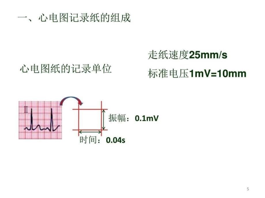 心电图测量方式和正常心电图_第5页