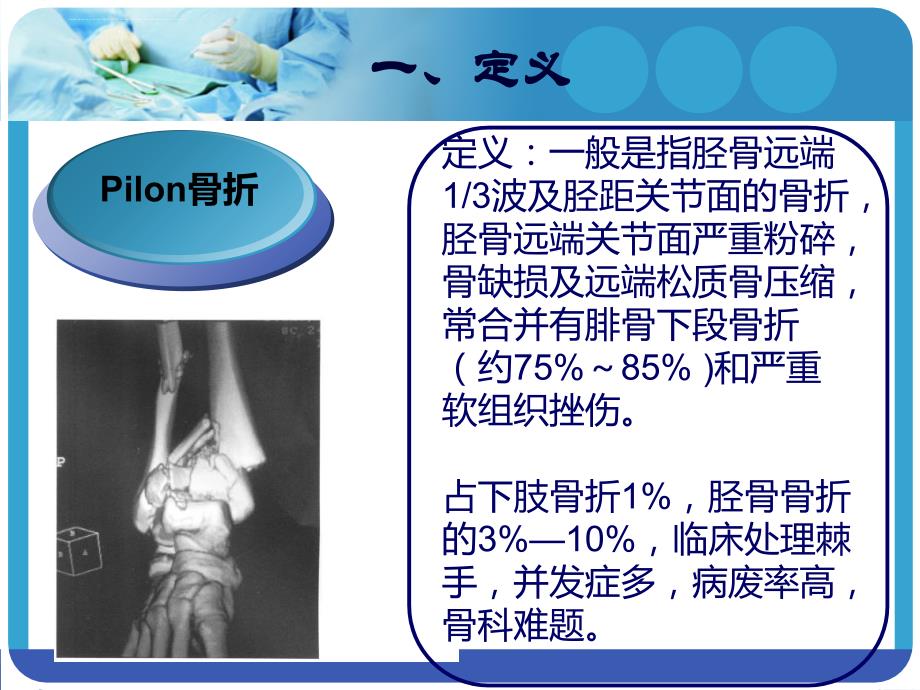 Pilon-骨折的诊疗和疗效评价_第3页