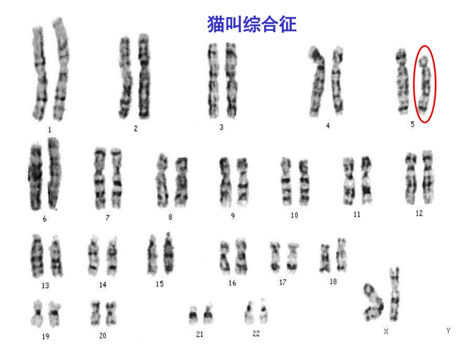 染色体结构突变导致的畸形_第2页