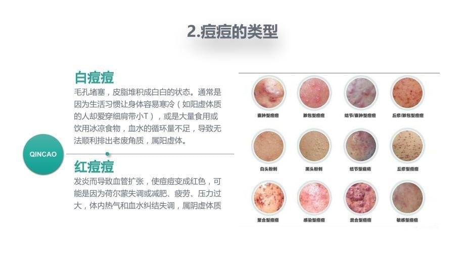 七老痘痘肌肤各种类型_第5页