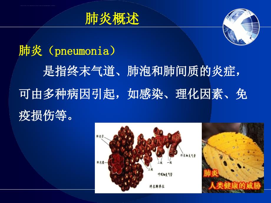 肺炎病人的护理PPT-(1)_第3页