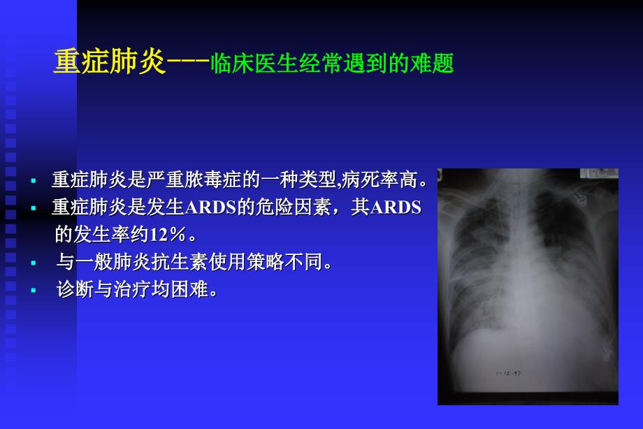 重症肺炎抗生素选择原则资料_第3页