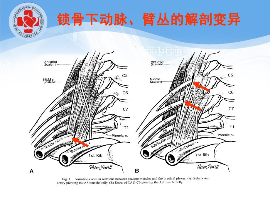 超声引导麻醉穿刺基础资料_第3页