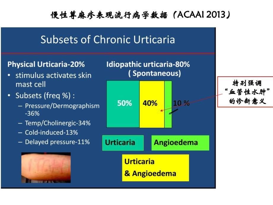 2014版中国荨麻疹指南解读.ppt_第5页