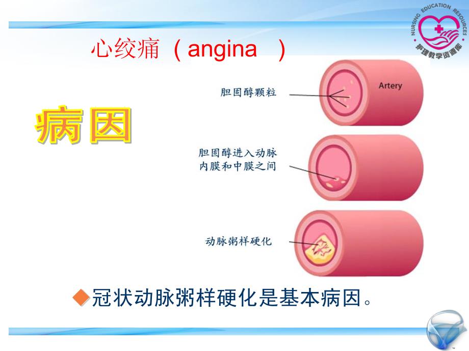 成人护理上册李晶江领群电子教案3-1冠心病_第3页