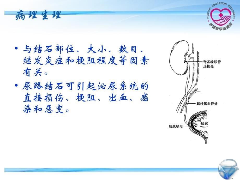 成人护理下册顾志华方志美3-2-电子教案-泌尿系统结石_第5页