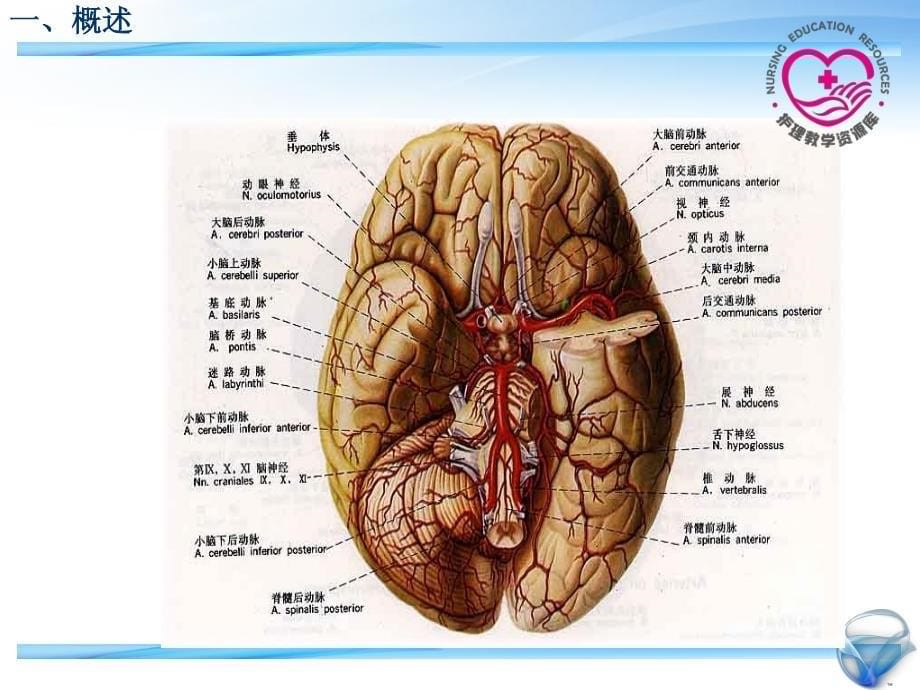成人护理下册顾志华方志美3-2-脑血管疾病病人的护理_第5页
