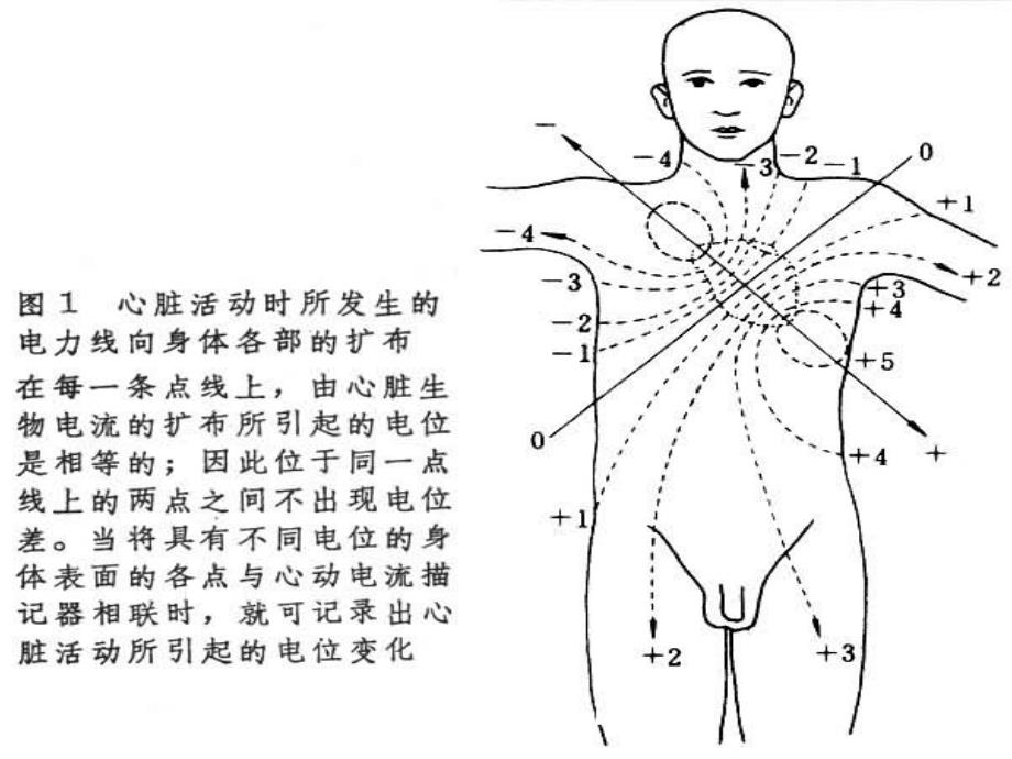 心电图讲义.ppt_第4页