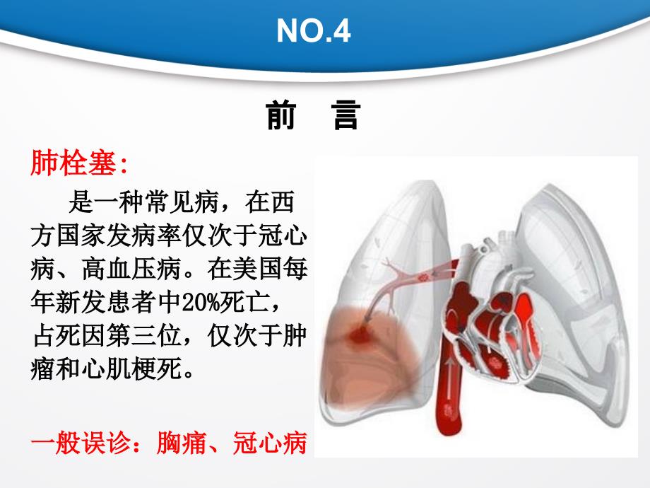 中医调理预防致命的肺栓塞_第4页