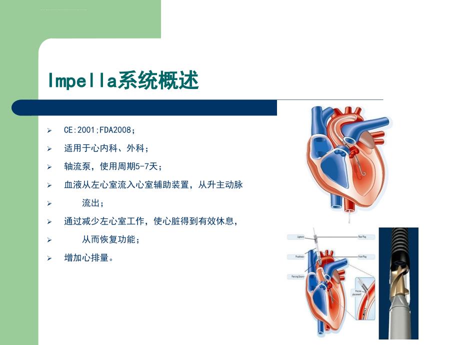 Impella系统在心内科的.ppt_第4页