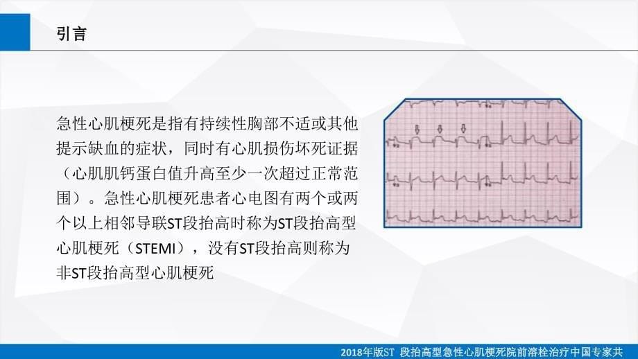 解读ST段抬高型急性心肌梗死院前溶栓治疗专家共识_第5页