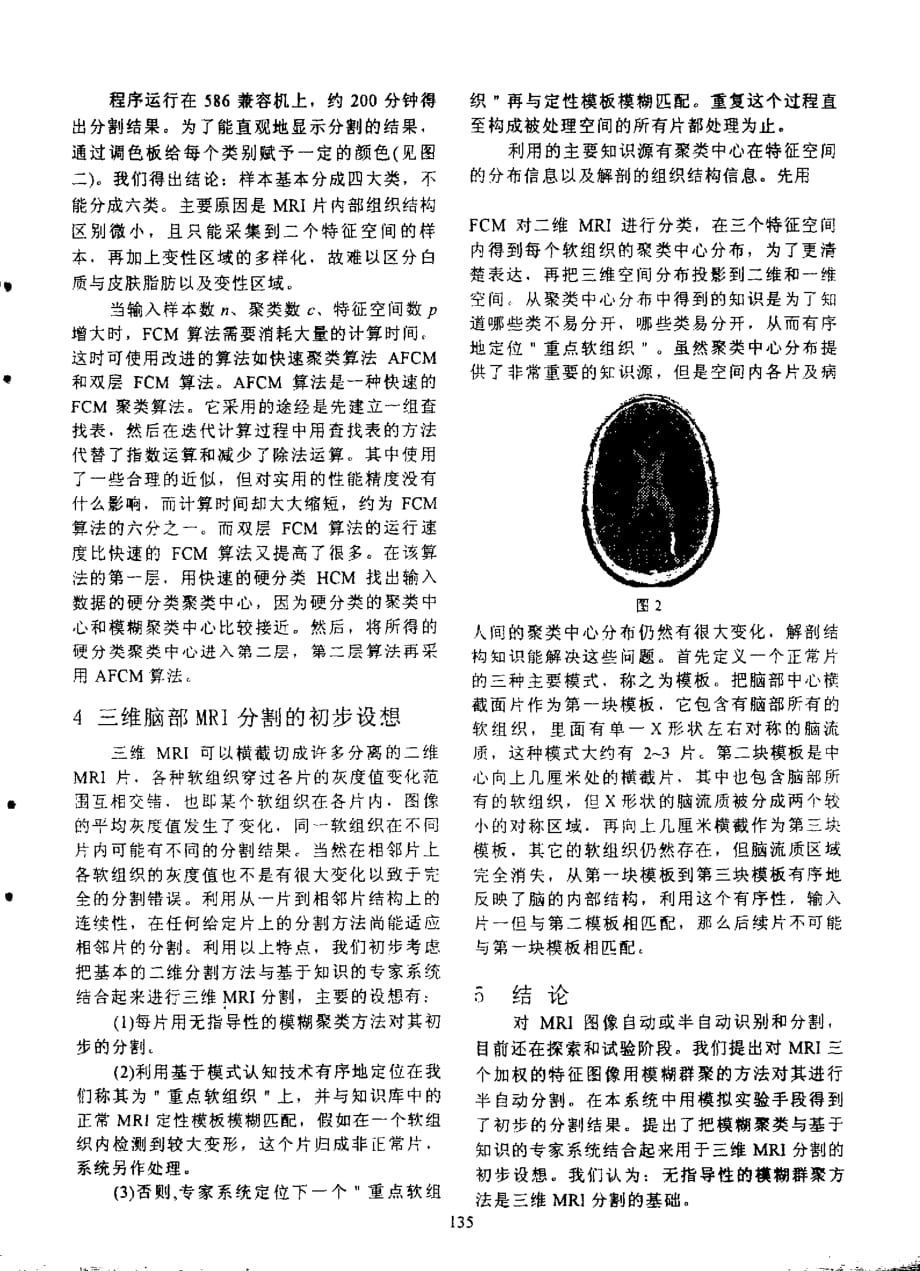 无指导的模糊聚类的多回波脑部磁共振图像分割_第3页