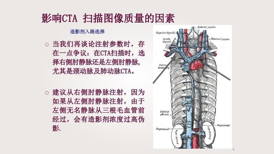 头颈部CTA及解剖_第5页