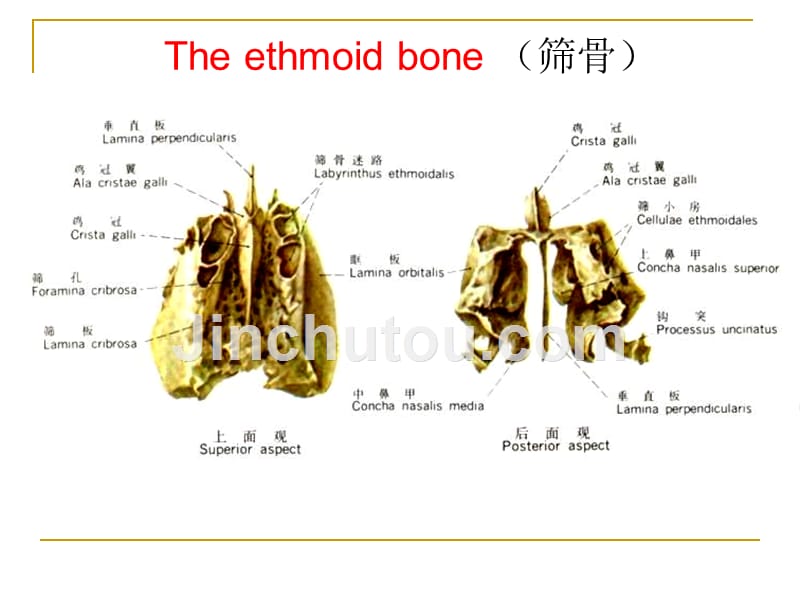 颅底结构的影像解剖及病变分析--肖慧_第5页