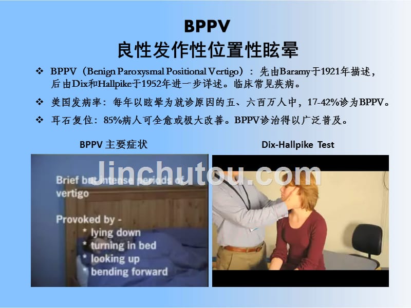 BPPV-CPPV良性位置性眩晕课件_第2页