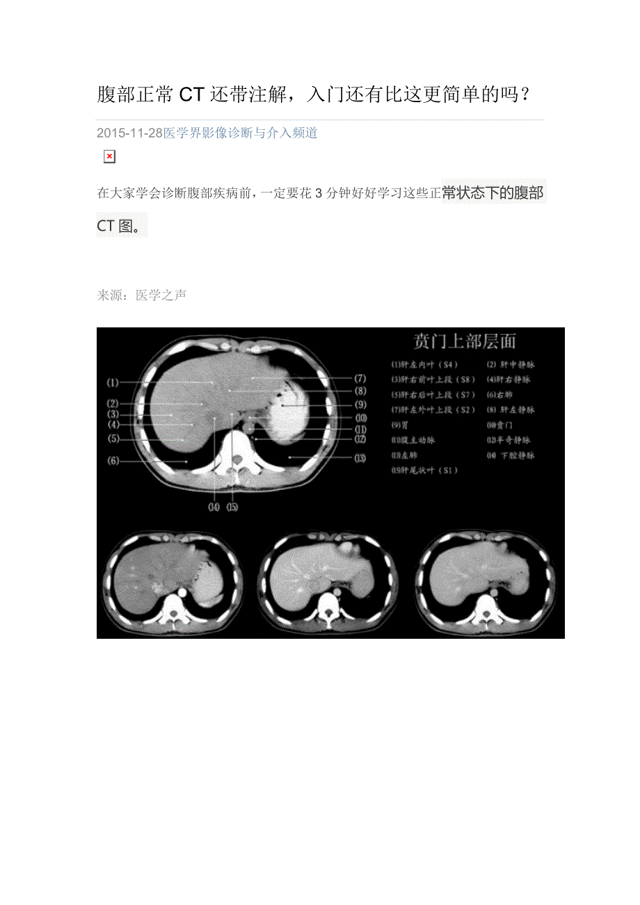 腹部正常ct._第1页