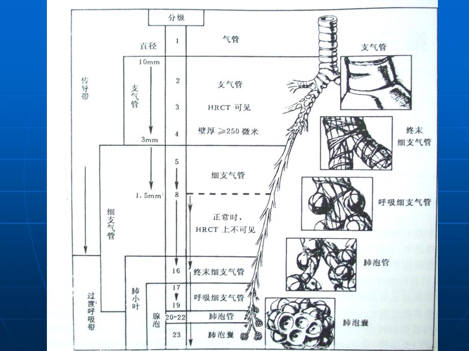 肺部正常HRCT表现及肺气肿诊断教材_第3页