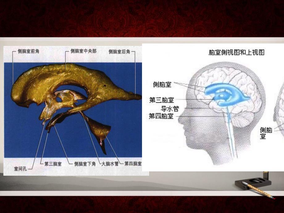 脑室镜颅底造瘘术 (2)讲解_第4页