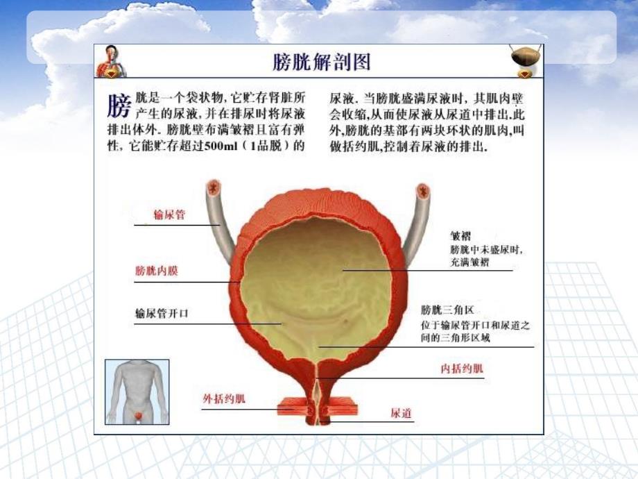 膀胱癌的治疗与护理讲解_第4页