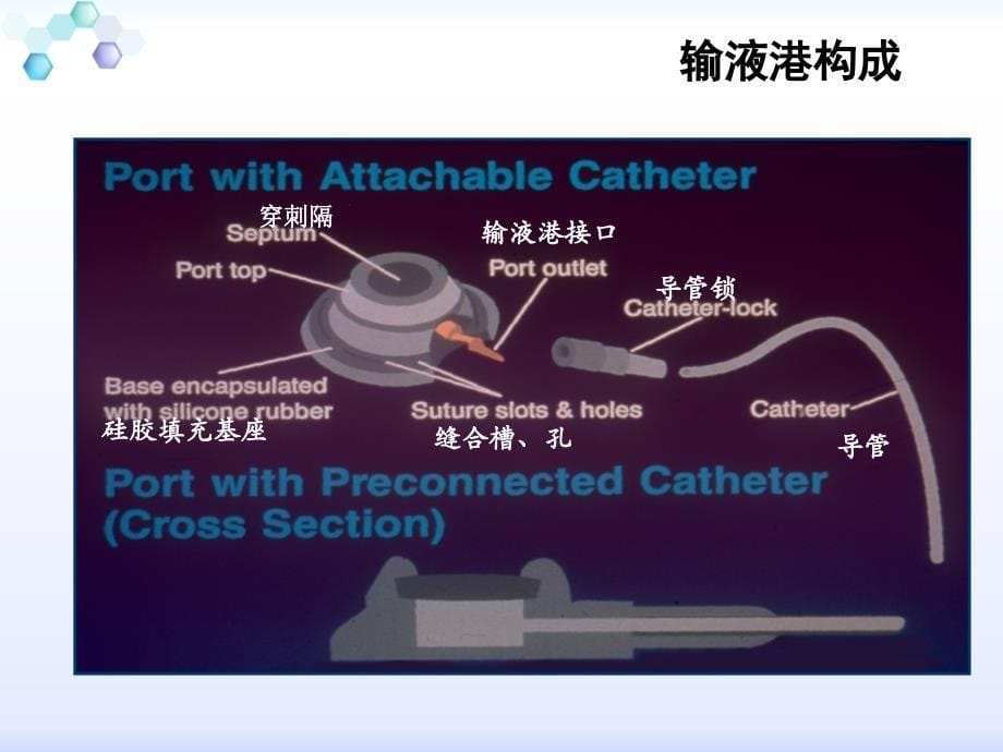 输液港日常维护和并发症护理讲解_第5页