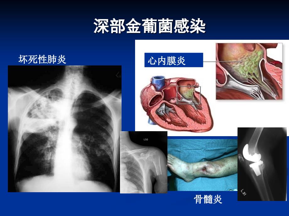 斯沃的强效与广谱讲解_第2页