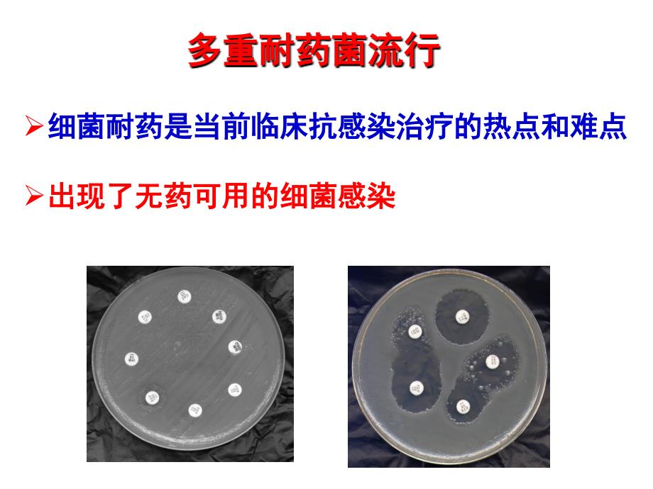 碳青霉烯暴露后的抗生素选择策略剖析_第3页