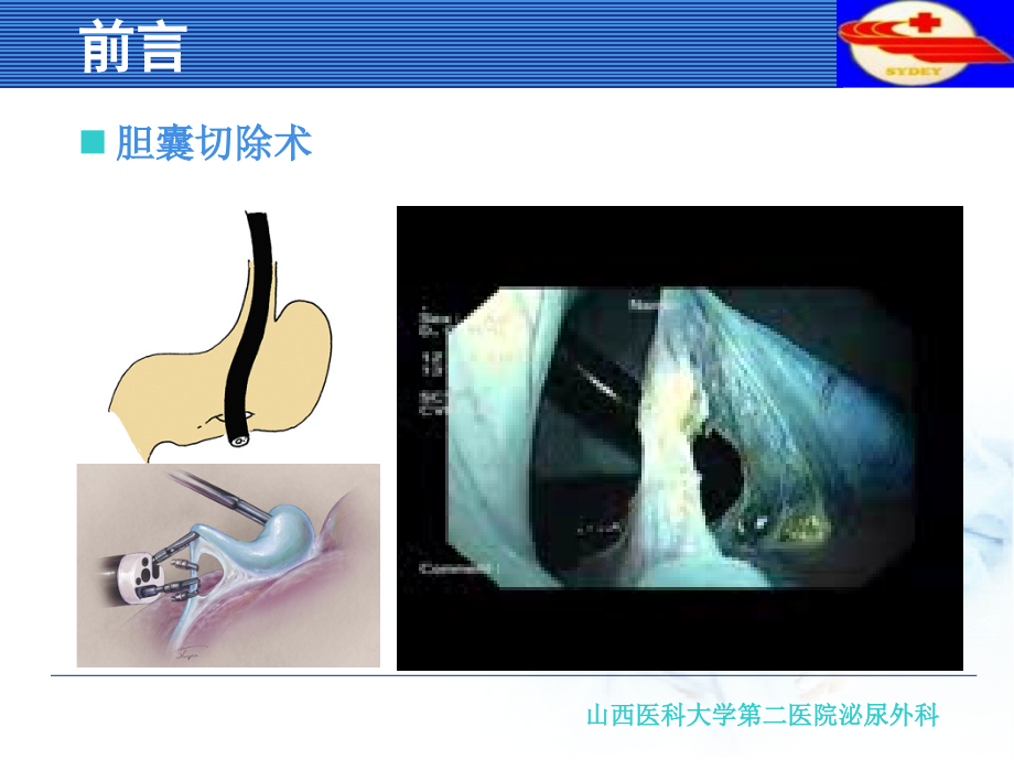 notes经自然腔道内镜手术_第2页